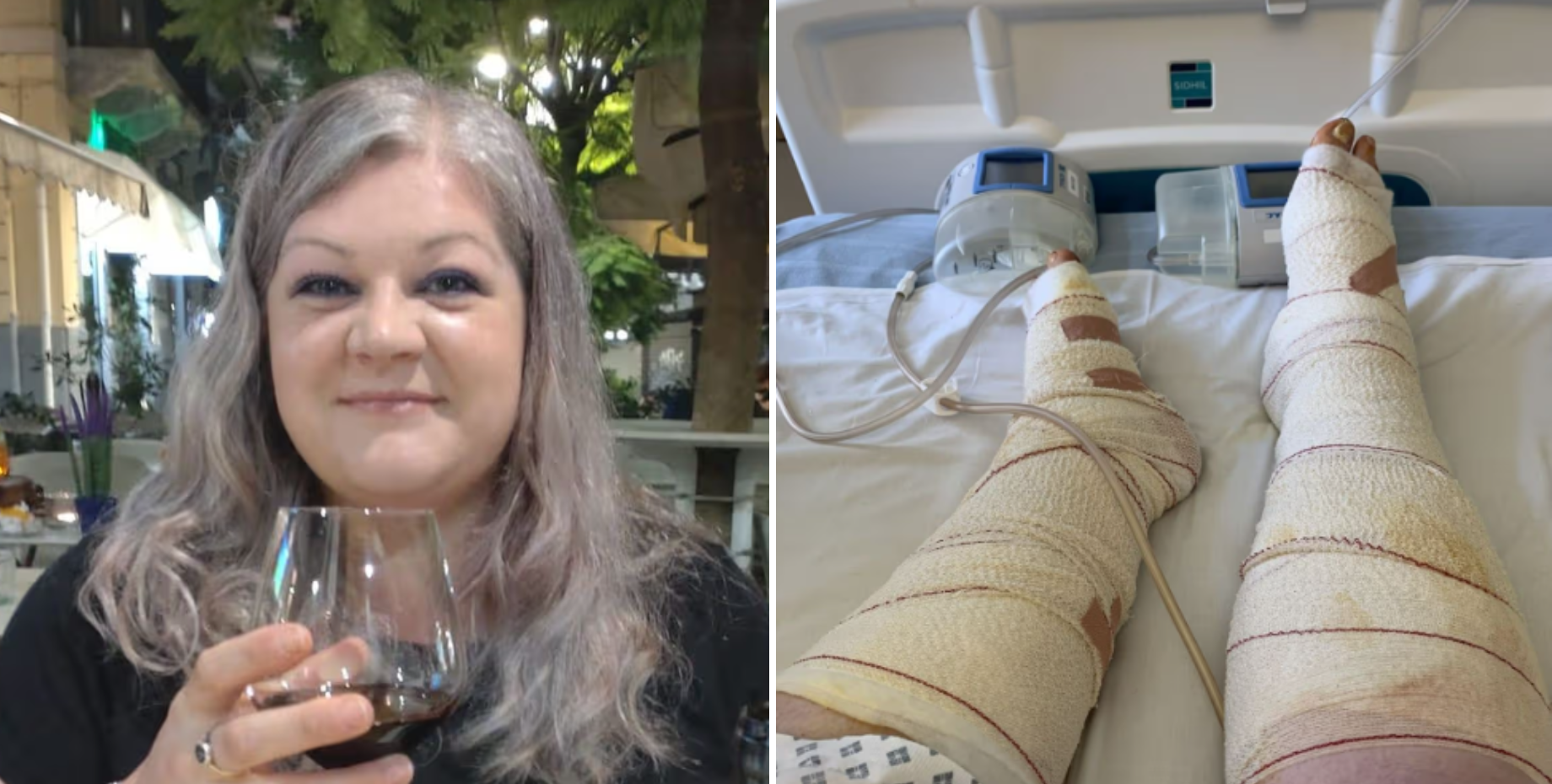 «Или операция — или морг»: врачи шокировали туристку после того, что с ней произошло в Италии