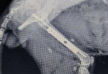 Маленький боец с фронта: в Харькове спасли кота, пережившего ужас войны