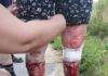 Золочевщина подверглась масштабным атакам: пострадали люди, среди них ребенок