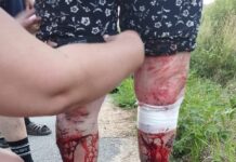 Золочевщина подверглась масштабным атакам: пострадали люди, среди них ребенок