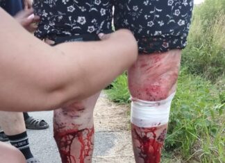 Золочевщина подверглась масштабным атакам: пострадали люди, среди них ребенок