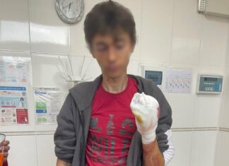 Мина прямо на дороге: в Харьковской области пострадал 19-летний велосипедист